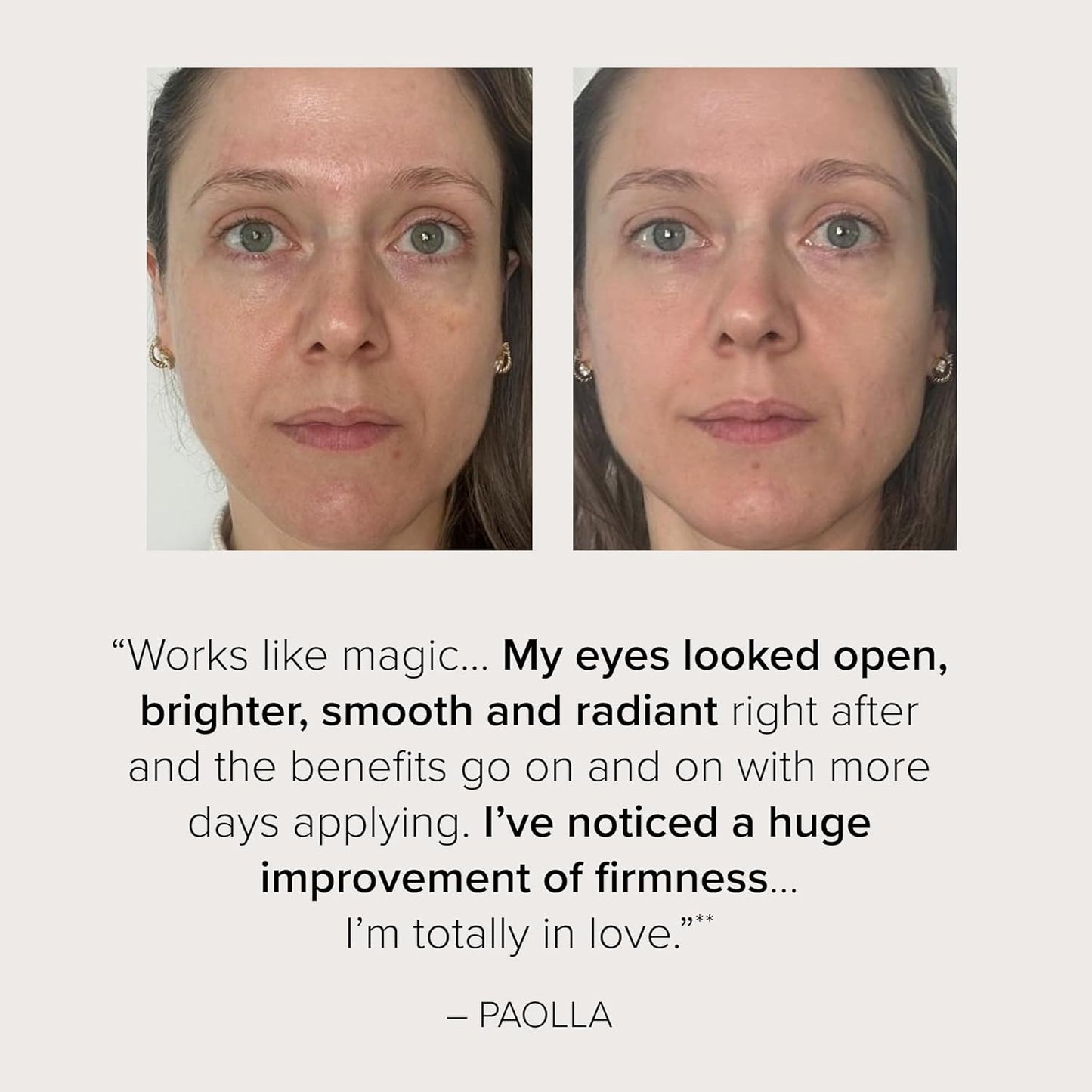 Serovital Beauty Dark Circle Eraser – Brightening & Anti‑Puffiness Under-Eye Treatment with Peptides, Dark Circle Corrector – eye corrector for dark circles - Hormone-Aware, Clinically Tested – 15mL